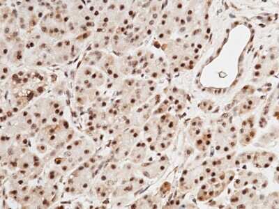 Immunohistochemistry-Paraffin: SPINK4 Antibody [NBP2-99857]