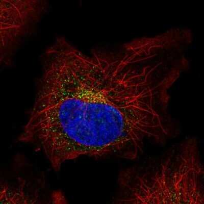 Immunocytochemistry/ Immunofluorescence: SPINK5 Antibody [NBP1-90510]