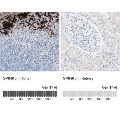 Immunohistochemistry-Paraffin: SPINK5 Antibody [NBP1-90509]