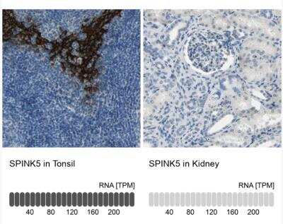 Immunohistochemistry-Paraffin: SPINK5 Antibody [NBP1-90510]