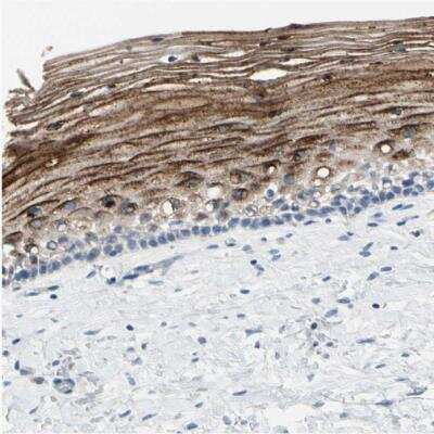 Immunohistochemistry-Paraffin: SPINK5 Antibody [NBP1-90510]