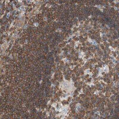 Immunohistochemistry: SPINK6 Antibody [NBP2-13371]