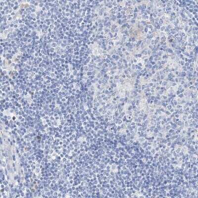 Immunohistochemistry-Paraffin: SPINK7 Antibody [NBP1-84015]