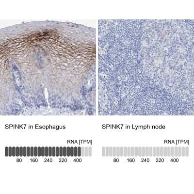 Immunohistochemistry-Paraffin: SPINK7 Antibody [NBP1-84015]