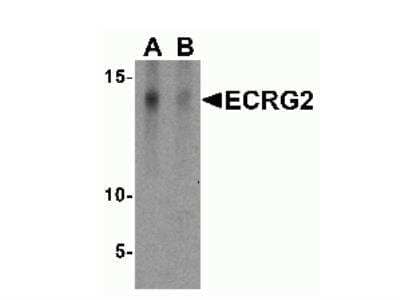 Western Blot: SPINK7 AntibodyBSA Free [NBP2-41141]