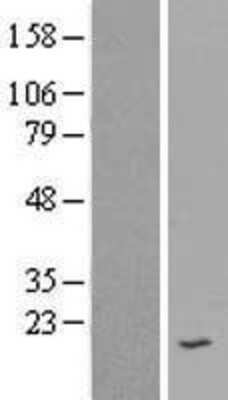 Western Blot: SPINK7 Overexpression Lysate [NBP2-05993]