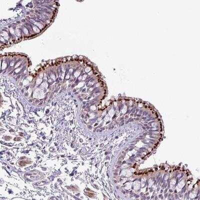 Immunohistochemistry-Paraffin: SPINK8 Antibody [NBP2-14777]