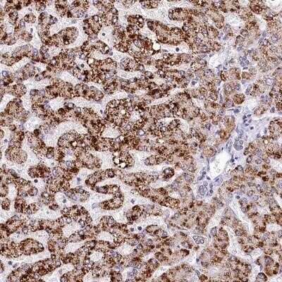 Immunohistochemistry-Paraffin: SPINK9 Antibody [NBP1-90990]