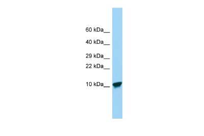 Western Blot: SPINK9 Antibody [NBP2-83594]