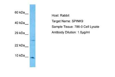 Western Blot: SPINK9 Antibody [NBP2-83595]