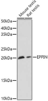 Western Blot: SPINLW1 AntibodyAzide and BSA Free [NBP3-05629]