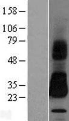 Western Blot: HAI-2/SPINT2 Overexpression Lysate [NBL1-16410]