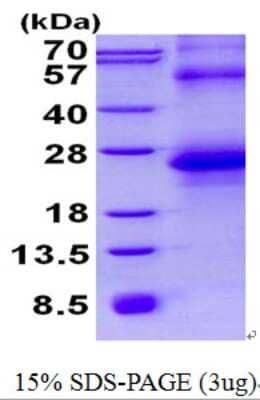 SDS-PAGE: Recombinant Human HAI-2/SPINT2 His Protein [NBP2-23460]