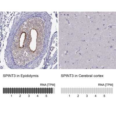 Immunohistochemistry-Paraffin: SPINT3 Antibody [NBP2-62604]