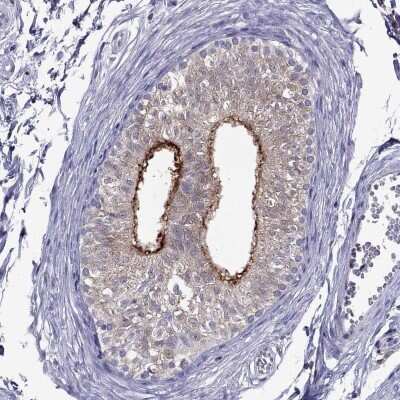 Immunohistochemistry-Paraffin: SPINT3 Antibody [NBP2-62604]
