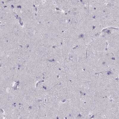 Immunohistochemistry-Paraffin: SPINT3 Antibody [NBP2-62604]