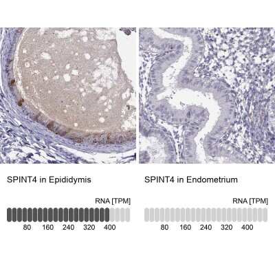 Immunohistochemistry-Paraffin: SPINT4 Antibody [NBP2-62613]