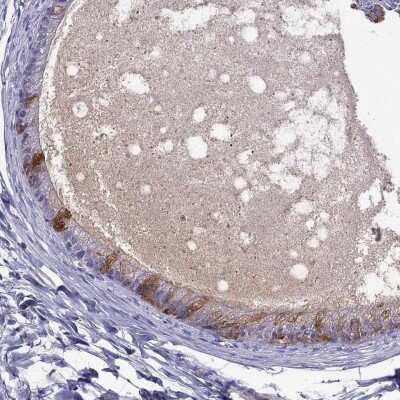 Immunohistochemistry-Paraffin: SPINT4 Antibody [NBP2-62613]