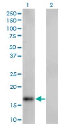 Western Blot: SPIRE1 Antibody (4C5) [H00056907-M01]