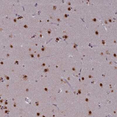 Immunohistochemistry-Paraffin: SPIRE1 Antibody [NBP1-92438]