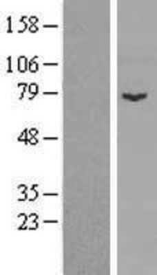 Western Blot: SPIRE1 Overexpression Lysate [NBP2-06666]