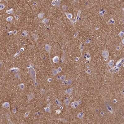 Immunohistochemistry-Paraffin: SPIRE2 Antibody [NBP2-47261]
