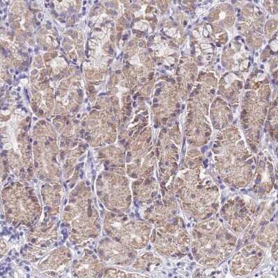 Immunohistochemistry-Paraffin: SPIRE2 Antibody [NBP2-30506]