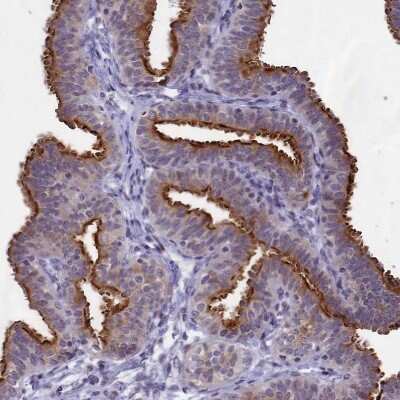 Immunohistochemistry-Paraffin: SPIRE2 Antibody [NBP2-47261]