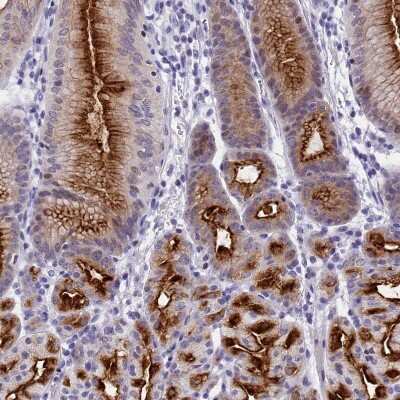 Immunohistochemistry-Paraffin: SPIRE2 Antibody [NBP2-47261]