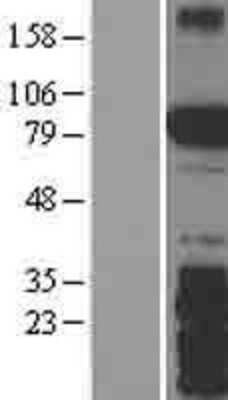 Western Blot: SPIRE2 Overexpression Lysate [NBL1-16411]