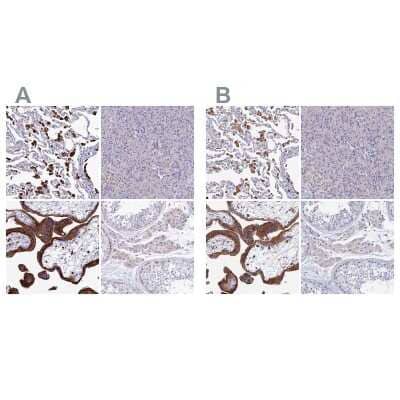 Immunohistochemistry-Paraffin: SPNS1 Antibody [NBP1-92440]