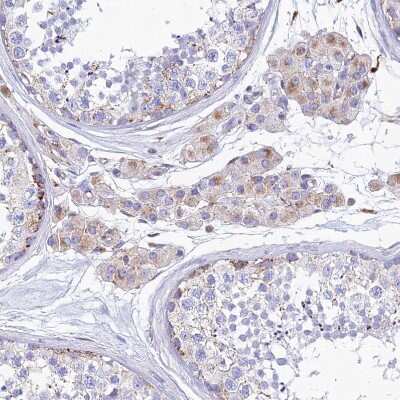 Immunohistochemistry-Paraffin: SPNS1 Antibody [NBP1-92440]