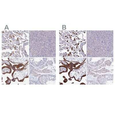 Immunohistochemistry-Paraffin: SPNS1 Antibody [NBP1-92441]