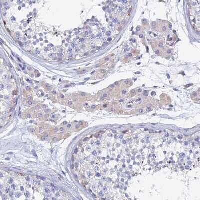 Immunohistochemistry-Paraffin: SPNS1 Antibody [NBP1-92441]