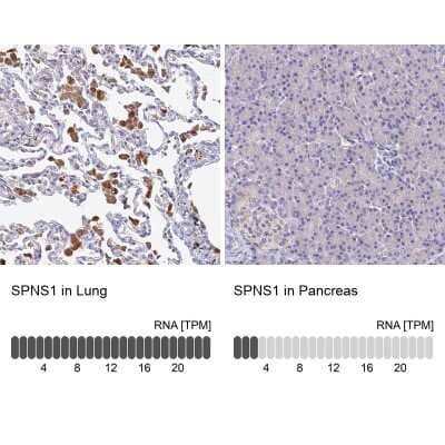 Immunohistochemistry-Paraffin: SPNS1 Antibody [NBP1-92441]