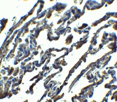 Immunohistochemistry-Paraffin: SPNS1 Antibody - BSA Free [NBP2-41252]