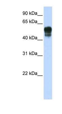 Western Blot: SPNS1 Antibody [NBP1-59999]