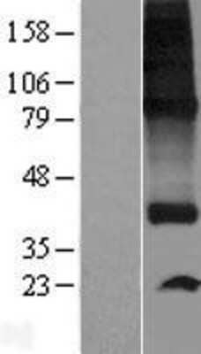 Western Blot: SPNS1 Overexpression Lysate [NBP2-06080]