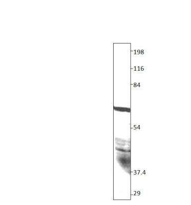 Western Blot: SPNS2 Antibody [NBP3-12351]