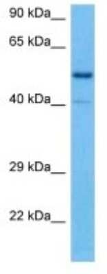 Western Blot: SPNS3 Antibody [NBP3-10204]