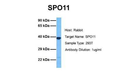 Western Blot: SPO11 Antibody [NBP1-58172]