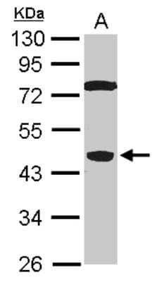 Western Blot: SPO11 Antibody [NBP2-20475]