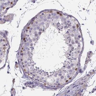 Immunohistochemistry: SPOCD1 Antibody [NBP2-38187]