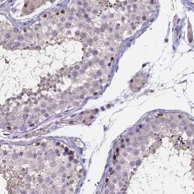 Immunohistochemistry: SPOCD1 Antibody [NBP2-48617]