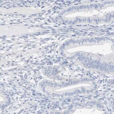 Immunohistochemistry-Paraffin: SPOCD1 Antibody [NBP1-93922]