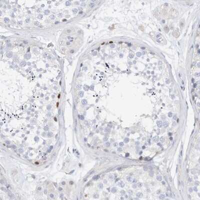 Immunohistochemistry-Paraffin: SPOCD1 Antibody [NBP1-93922]