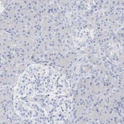 Immunohistochemistry-Paraffin: SPOCD1 Antibody [NBP1-93922]