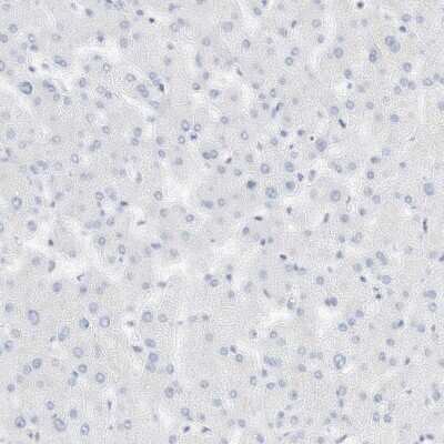 Immunohistochemistry-Paraffin: SPOCD1 Antibody [NBP1-93922]
