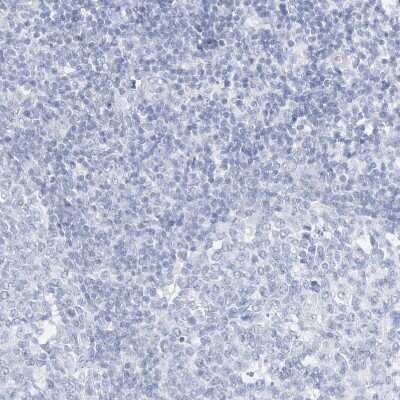 Immunohistochemistry-Paraffin: SPOCD1 Antibody [NBP1-93922]