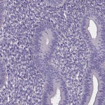Immunohistochemistry-Paraffin: SPOCD1 Antibody [NBP2-38187]